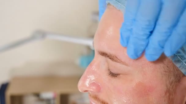 美容师在男性病人脸上用戴着手套的手擦拭酸剥脱液。皮肤护理和有问题的皮肤的程序。在美容院接受面部治疗的年轻人。Vrtical — 图库视频影像