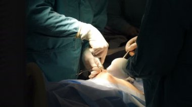 Cerrah, hastanede cerrahi operasyon sırasında göbek kanalından karın boşluğuna giriyor. Tıbbi prosedürün bir parçası. Üniformalı profesyonel cerrahlar göbek bağıyla hasta ameliyat ediyorlar.