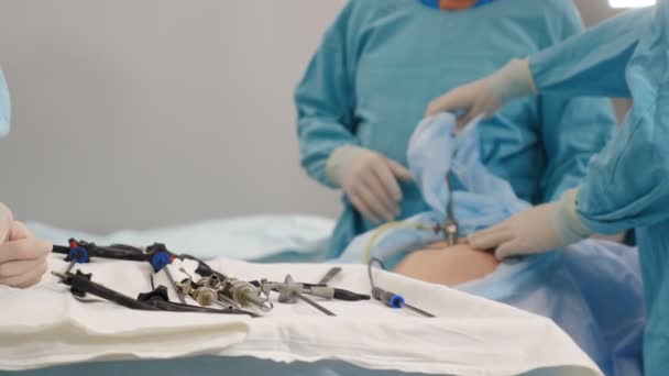 Chirurgische ziekenhuis specialist team in scrubs in operatiekamer uitvoeren van laparoscopische chirurgie met behulp van video monitor afspelen en Endoscoop en Laparoscoop instrumenten. 4 k video — Stockvideo