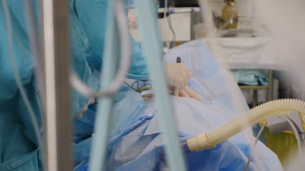 ヘルスケア。手術室の外科専門チームは、ビデオモニター再生と内視鏡および腹腔鏡機器を使用して腹腔鏡手術を実行しています。閉鎖だ。4 kビデオ — ストック動画