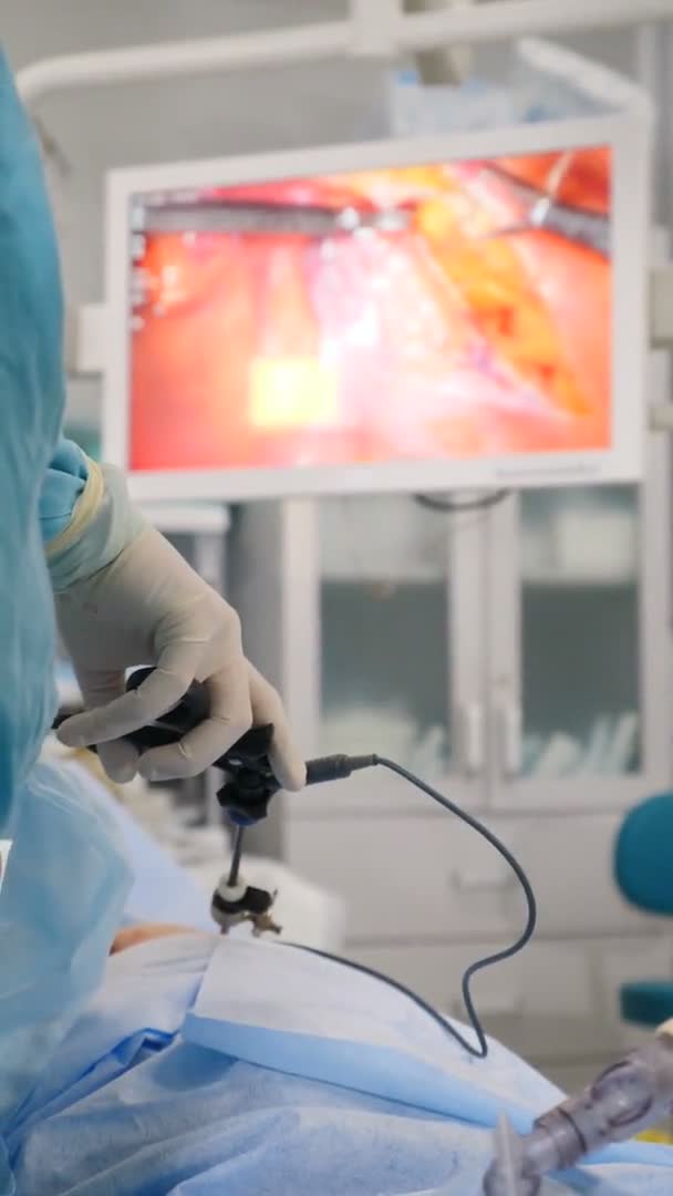 Chirurgische ziekenhuis specialist team in scrubs in operatiekamer uitvoeren van laparoscopische chirurgie met behulp van video monitor afspelen en Endoscoop en Laparoscoop instrumenten. Verticale beelden. 4 k video — Stockvideo