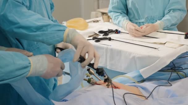 Cirugía laparoscópica en el hospital. Equipos médicos modernos en quirófano. Intervención quirúrgica en la cavidad abdominal para el tratamiento o eliminación de la patología, movimientos precisos cuidadosos del médico — Vídeos de Stock