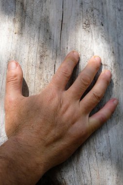 Orman bekçisi ağaç kabuğu olmayan hastalıklı bir ağaç gösteriyor. Ağaç kabuk böcekleri tarafından tahrip edildi..