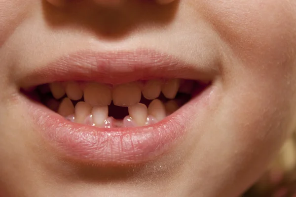 Sonrisa de un niño —  Fotos de Stock