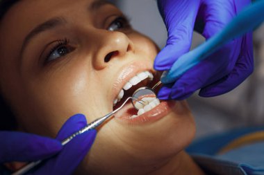 Eldivenli dişçinin yakın plan fotoğrafı klinikte dişçi aynası ile kadın dişlerini kontrol ediyor.