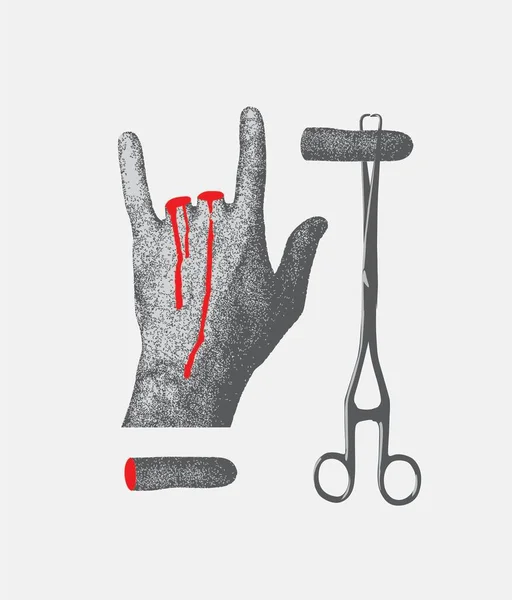 Ilustracja Wektorowa Ludzkiej Ręki Odciętymi Palcami Pokazująca Kozę Chirurgicznym Pęsetą — Wektor stockowy