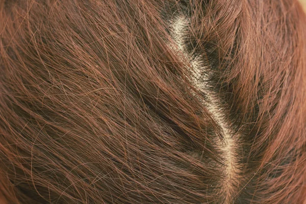 Καστανά μαλλιά — Φωτογραφία Αρχείου