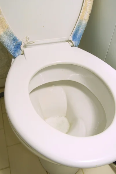 Limpeza do vaso sanitário — Fotografia de Stock