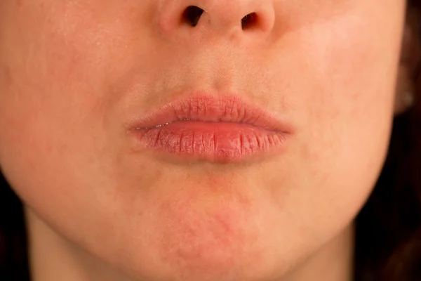 Closeup of kissing woman — Stock Photo, Image