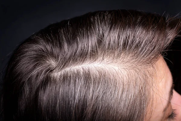 Frauenkopf Mit Grauen Haaren Nahaufnahme Nachwachsender Wurzeln Draufsicht Auf Dunklem — Stockfoto