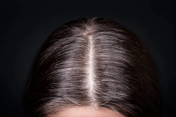 Gri Saçlı Kadınlar Yeniden Büyüyen Kökleri Yakından Gören Koyu Arkaplan — Stok fotoğraf