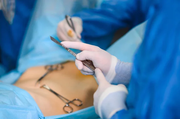 Endoskop Kullanarak Laparoskopik Ameliyat Modern Ameliyat Minimum Invazif Ameliyat — Stok fotoğraf