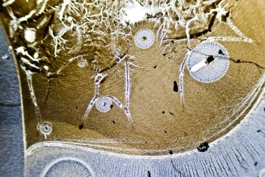 mikroskobik is parçacıkları