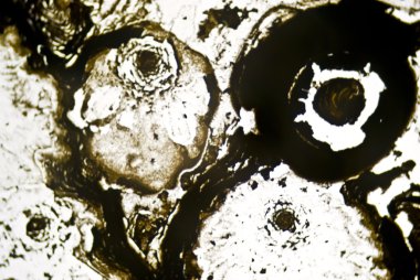 mikroskobik is parçacıkları