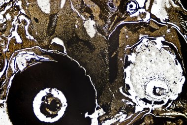 mikroskobik is parçacıkları