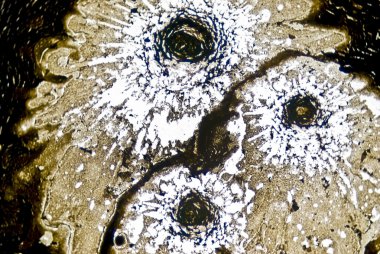 mikroskobik is parçacıkları