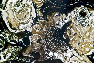 mikroskobik is parçacıkları