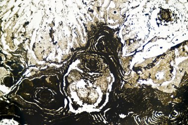 mikroskobik is parçacıkları