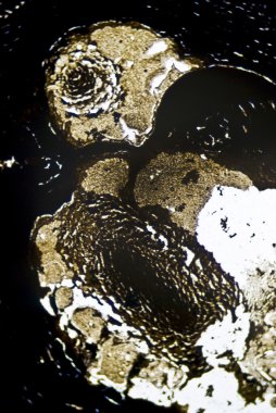 mikroskobik is parçacıkları