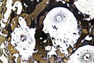 mikroskobik is parçacıkları