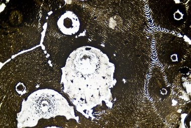 mikroskobik is parçacıkları