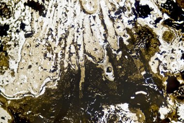 mikroskobik is parçacıkları