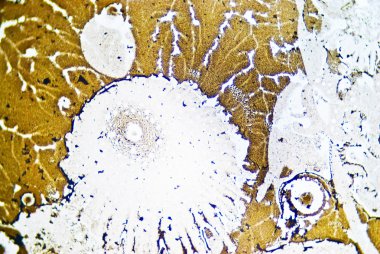 mikroskobik is parçacıkları