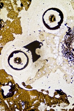 mikroskobik is parçacıkları