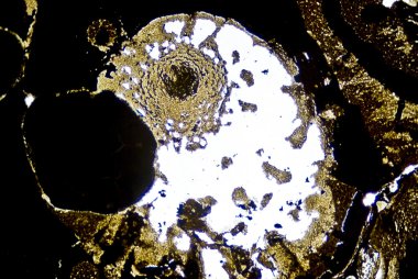 mikroskobik is parçacıkları