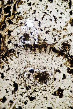 mikroskobik is parçacıkları