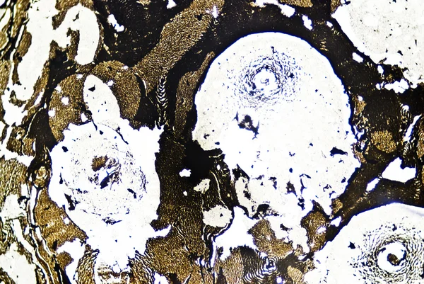 mikroskobik is parçacıkları