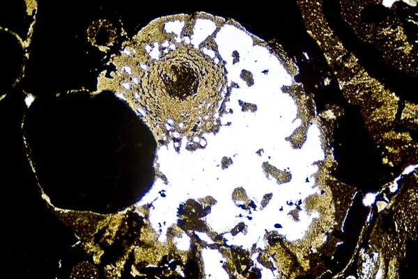 mikroskobik is parçacıkları