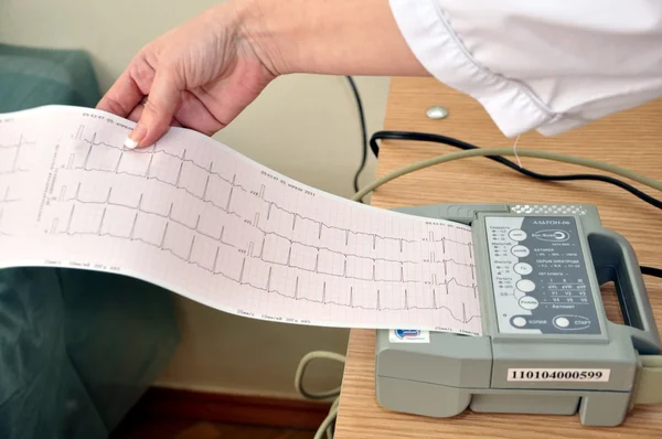 Papel gráfico con los resultados del ECG —  Fotos de Stock