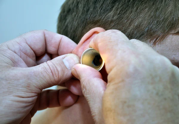 Ο γιατρός εξετάζει το αυτί του ασθενούς — Φωτογραφία Αρχείου