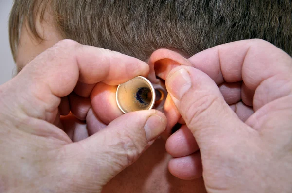 El médico examina el oído del paciente — Foto de Stock