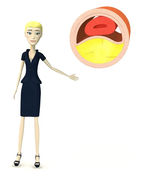 3d render of cartoon character with vein with cholesterol — Stock Photo, Image