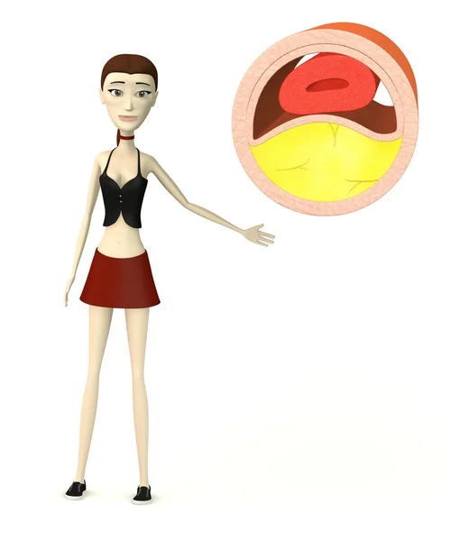 3d render of cartoon character with vein with cholesterol — Stock Photo, Image