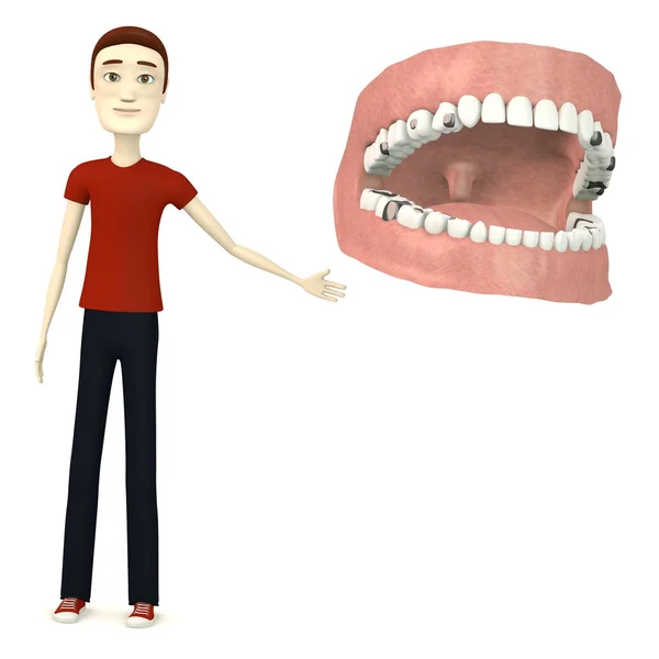 3D візуалізація мультиплікаційного персонажа з зубами та начинками — стокове фото