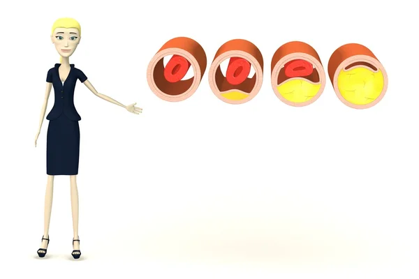 3d renderização de personagem de desenho animado com veias com colesterol — Fotografia de Stock
