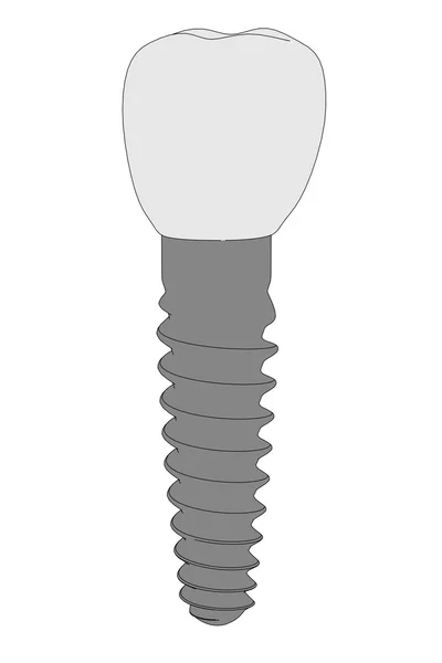 Cartoon image of tooth implant — Stock Photo, Image