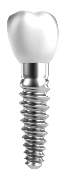diş implantı gerçekçi 3d render