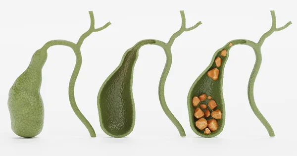 Safra kesesinin gerçekçi 3D görüntüsü