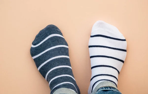 Odd Socks Day Concept Legs Different Socks Blue Background Top — Stock Photo, Image