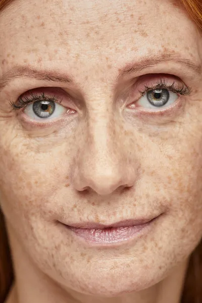 Fräknig kvinna ingen makeup — Stockfoto
