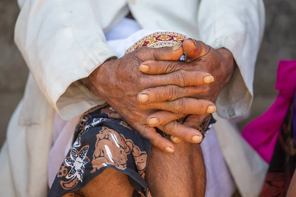 Aging Process Very Old Senior Man Hands Wrinkled Skin Island — Stock Photo, Image