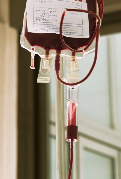 Blood transfusion — Stock Photo, Image