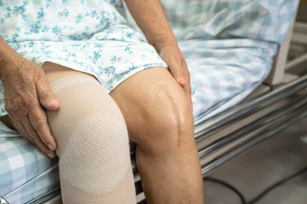 Aziatische Senior Oudere Oude Dame Patiënt Met Knie Ondersteuning Pijn — Stockfoto