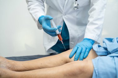Asyalı doktor, Hyaluronic asit trombosit enjekte ederek yaşlı kadının dizine zengin plazma enjekte etti..