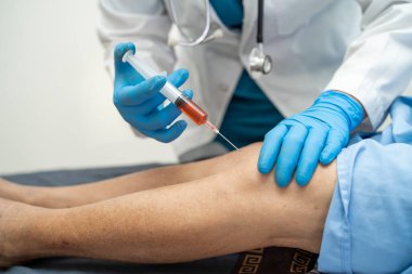 Asyalı doktor, Hyaluronic asit trombosit enjekte ederek yaşlı kadının dizine zengin plazma enjekte etti..