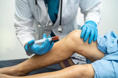 Asyalı doktor, Hyaluronic asit trombosit enjekte ederek yaşlı kadının dizine zengin plazma enjekte etti..